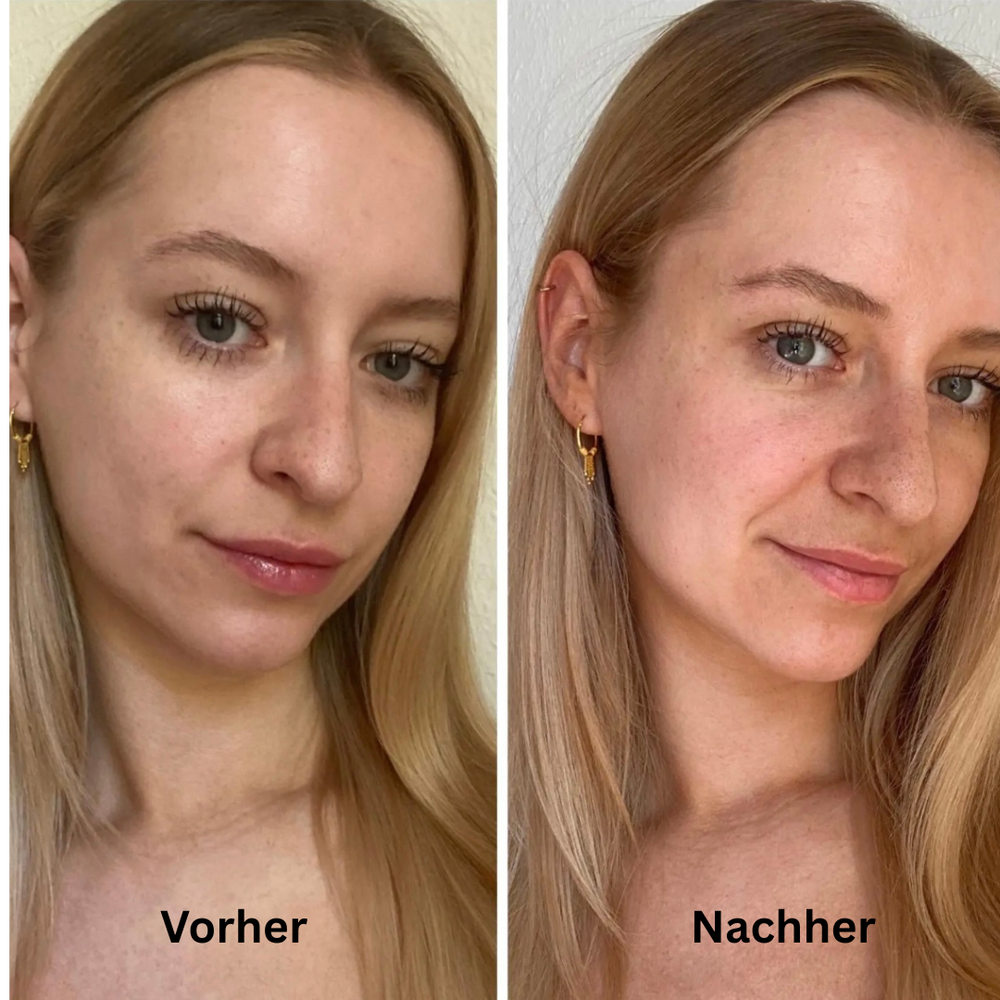 <p><strong>Vorher vs Glowbody</strong></p><p></p>