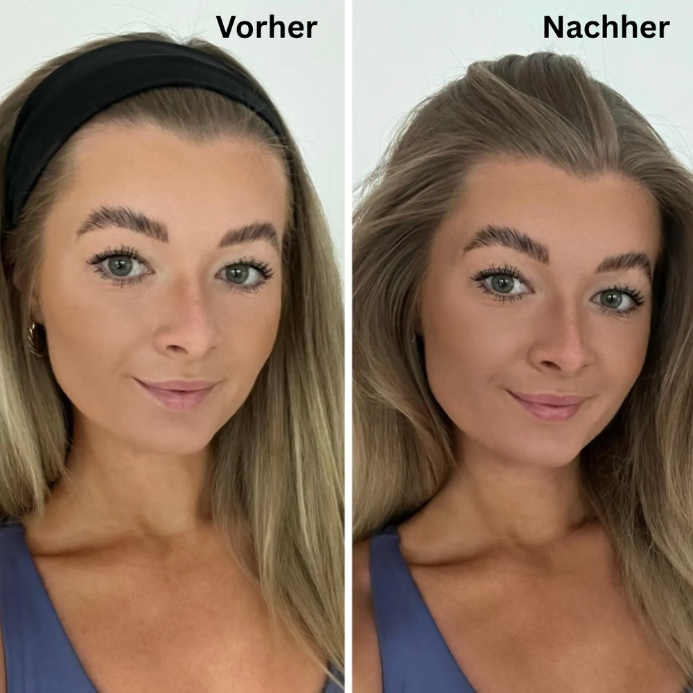 <p><strong>Vorher vs Glowbody</strong></p><p></p>