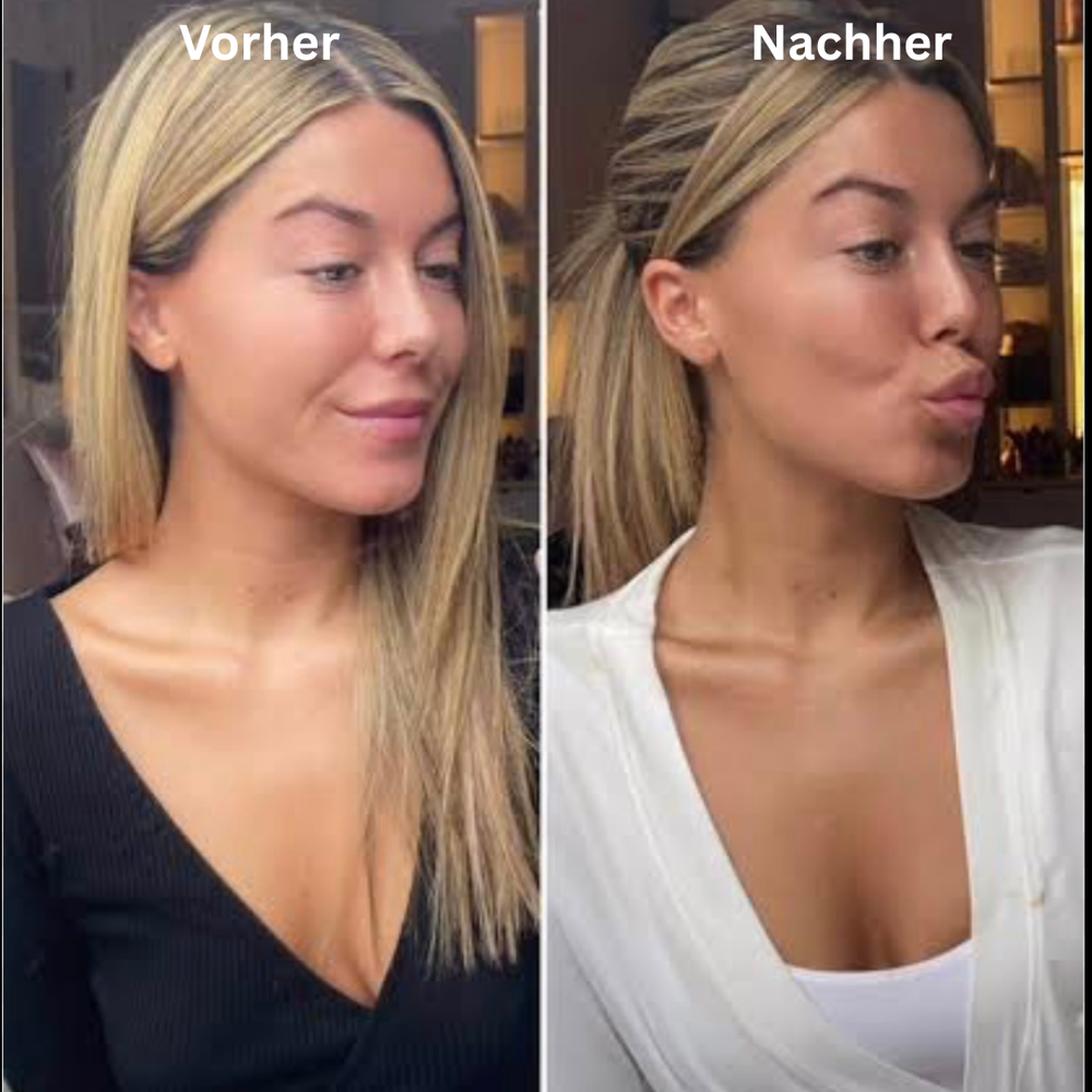 <p><strong>Vorher vs Glowbody</strong></p><p></p>