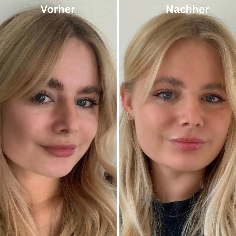 <p><strong>Vorher vs Glowbody</strong></p><p></p>