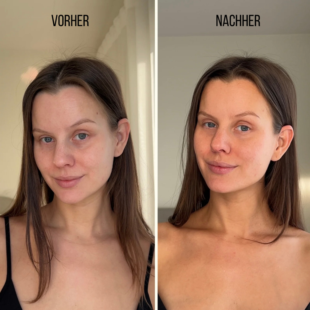 <p><strong>Vorher vs Glowbody</strong></p><p></p>