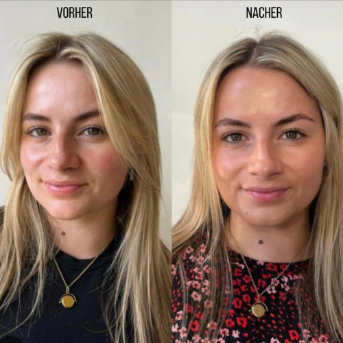 <p><strong>Vorher vs Glowbody</strong></p><p></p>